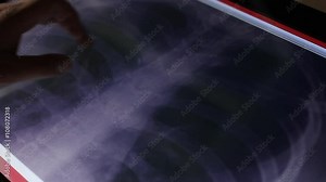 doctor examines human lungs and chest x-ray scan on touch screen computer