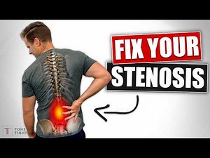 Fix Lower Back Stenosis And Sciatica! [Home Exercises For DDD And Arthritis]