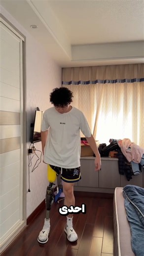 فقد إحدى ساقيه ولكن... 😮؟!