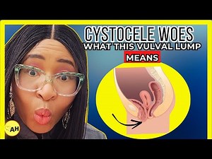 Cystocele Symptoms | What That Vulval Lump Means