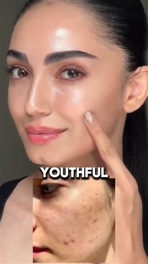 DIY Detox Tea for Glowing Skin, a Healthy Body & Feminine Wellness 🌿✨ #NaturalRecipes #FeminineHealth #usa #uk #usareels | Fit Women