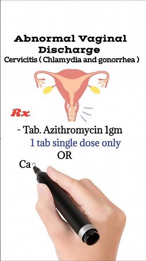 Abnormal Vaginal Discharge | Cervicitis Treatment