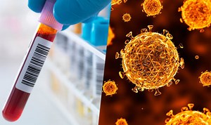 NHS Doctor explains symptoms and treatment of HIV