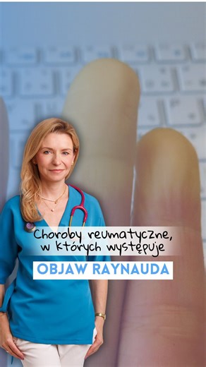 Agata Skwarek-Szewczyk | Lekarz | Reumatolog | Internista on Instagram: "Objaw Raynauda może być pierwszym sygnałem choroby reumatologicznej, dlatego nie warto go bagatelizować Najczęściej występuje w: • twardzinie układowej (bardzo charakterystyczny) • toczniu rumieniowatym układowym (SLE) • zespole Sjögrena • mieszanej chorobie tkanki łącznej (MCTD) • zapalnych miopatiach (polimyositis, dermatomyositis) • reumatoidalnym zapaleniu stawów (rzadziej) Jeśli Raynaud pojawia się nagle, jest bolesny,