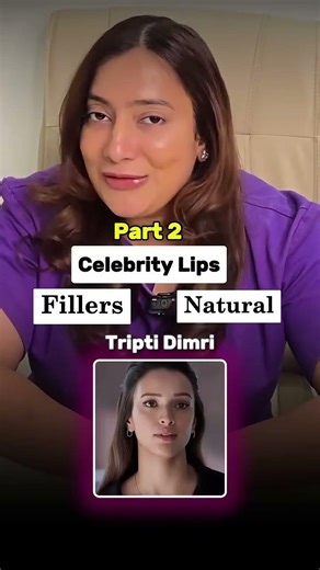 rating celebrity lips natural vs enhanced