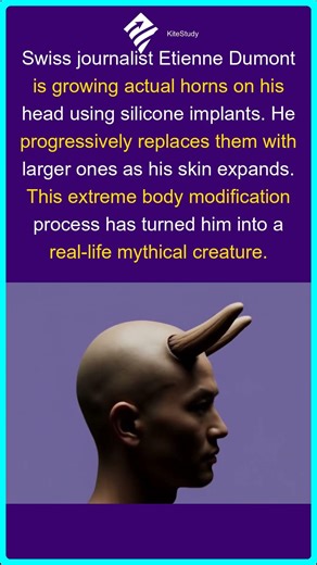 The Man Growing Real Horns