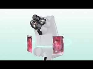 EVAPro Next Gen Digital Colposcope 3D - short clip with cervical images