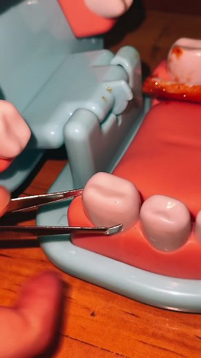 ⚠️FAKE BLOOD⚠️ Our first tooth pulling! How’d it go? #fyp #toothpull #foryou #smile #teeth #dentist #dentaltok #foryoupage