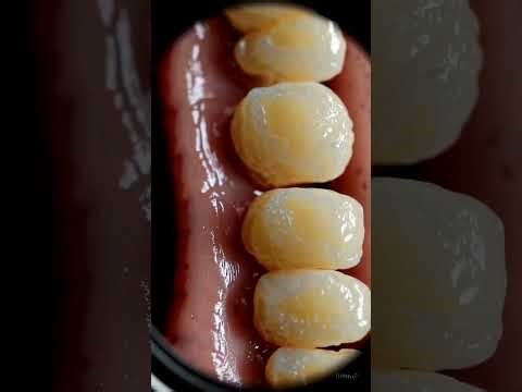 What Happens If You Don’t Brush Your Teeth? Full 4-Minute Dental Journey