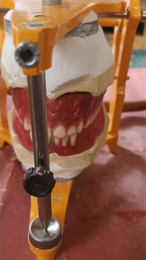 complete maxillary arch teeth arrangement 😬🦷
