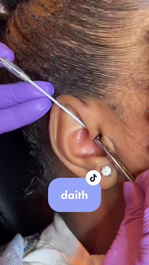 Daith Piercing Pain: What to Expect