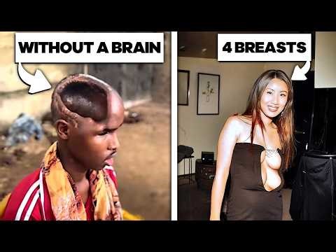 Real People with Truly Unique Bodies