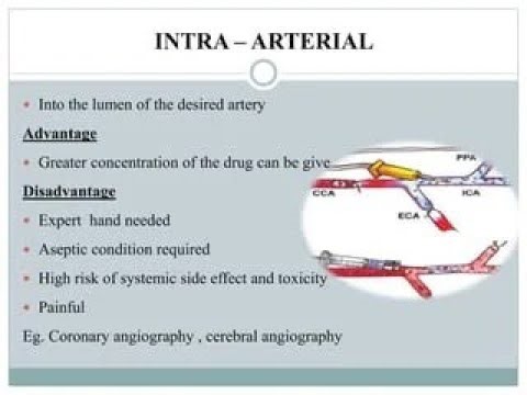 Intra Arterial Route of Drug Administration (Injection)