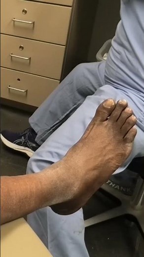 Cracked Heels & Thick Nails Smoothed Out | Instant Comfort | Nail Care Tips for Healthy Feet! 💅