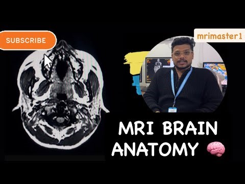 Mri brain Anatomy in Simple Hindi #mri#radiology #doctor #radiohead..by pawan kumar..