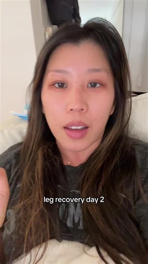 Day 2 of Leg Recovery: My Health Journey Update