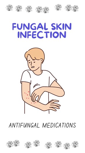 Fungal Infection (Treatment) 4 Dummies #fungalinfection #medicine #tips I think I have a fungal infection...? How kind of treatment should I use? Mycoban: https://shope.ee/6UylZV5n0R Zarin: https://shope.ee/7AESMhzKB0 Daktarin: https://shope.ee/4KuGzUEuki Canesten: https://shope.ee/4pqXaO9106 Canespro: https://shope.ee/2q5TCgutfV Lamisil cream: https://shope.ee/9zYdjixmkR Candazole: https://shope.ee/2VScnavMO5 Shopee Links: https://mycollection.shop/otc4dummies Guardian: https://shope.ee/VfjXcff