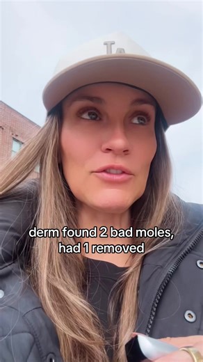 Importance of Yearly Skin Checks for Moles