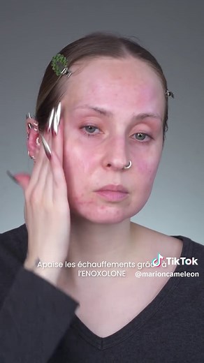 Sérum Roséliane d'URIAGE pour les peaux sensibles