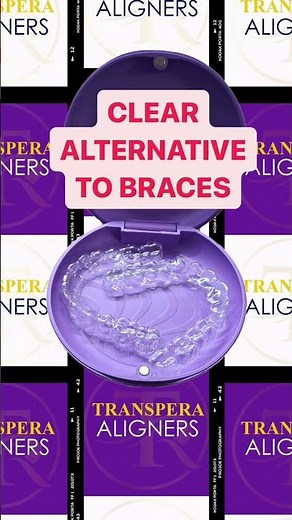 Get Your Dream Smile with Transpera Clear Aligners! #clearbraces #smilemakeover #dentalaligners