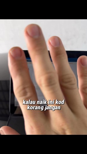 8.7K views · 216 reactions | Naik Code P0344 Honda Civic Apa Perlu Buat Sila Lihat Video Sampai Habis | Hup Seng Car Repair & Service | Facebook