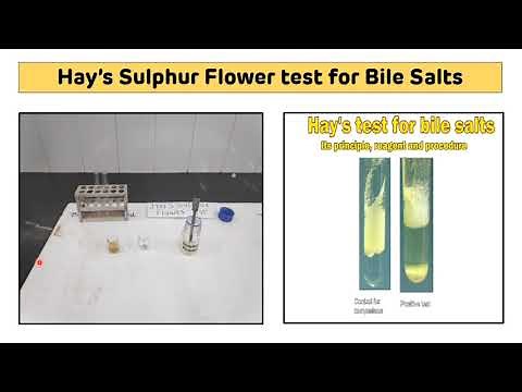 Hay's Sulphur Flower Test for Bile Salts In Urine || Hay's Sulphur Powder Test