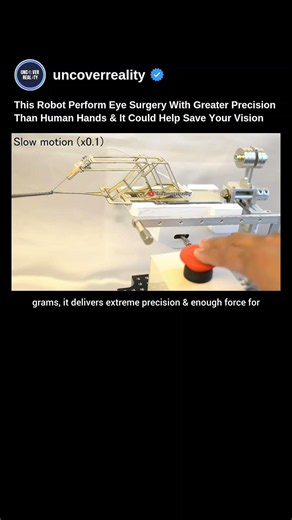This Robot Performs Eye Surgery With High Precision Than Humans & Help Save Vision #robot #shorts