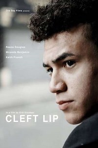 Cleft Lip - Movie
