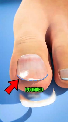 You’re Cutting Your Toenails Wrong… Here’s the Painful Reason