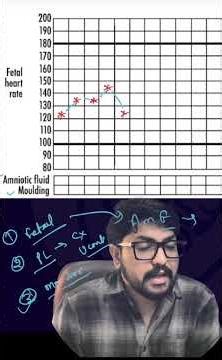 Partograph | Alert line vs Action line |what is Partograph #partograph #science #shortsfeed #shorts