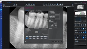 How to – Rotate, flip and crop 2D images in Planmeca Romexis
