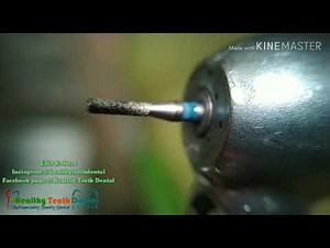 High Speed Dental Drill ( Airotor)