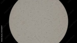 colony of bacteria living in dirty rotten water: Vibrio, spirilla, spirochaetes and others, under the microscope