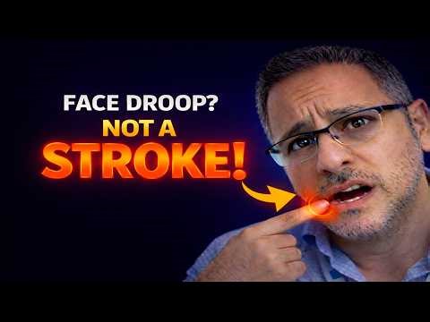 ⭐Face Drooping? NOT Always a Stroke — Here’s Why