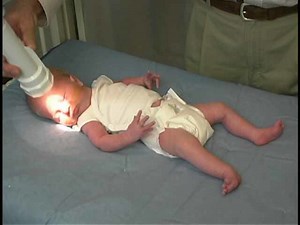 Neurologic Exam-Pediatric | Newborn | Abnormal | Behavior