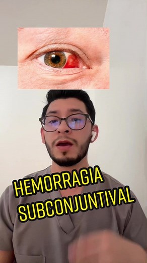Cómo eliminar un derrame ocular - Hemorragia subconjuntival