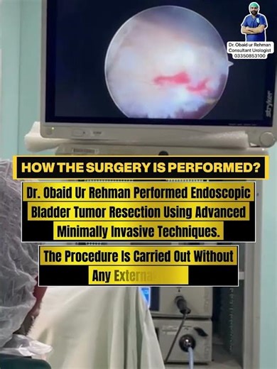 Bladder cancer surgery _TURBT, Never ignore blood in urine