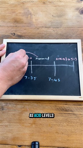 When a DKA patient starts breathing like this deep, rapid, and laboured it’s not because they’re short of breath. Their body’s trying to fix severe metabolic acidosis by blowing off CO₂. And that sweet “pear drop” smell? That’s acetone one of the ketones spilling out through the lungs. A perfect reminder of what’s really happening inside every DKA patient. Learn.Adapt.Respond | The Medical Lounge