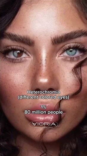 Most Rare eye colors you may have🩷💫 #shorts #glowup
