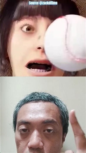 Unbelievable Moment: Hit by 2 Foul Balls in One Game 😳 #viralshorts #sportsmoment #fypシ゚