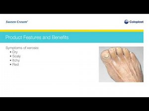 How to use Sween Cream from Coloplast and why its Important