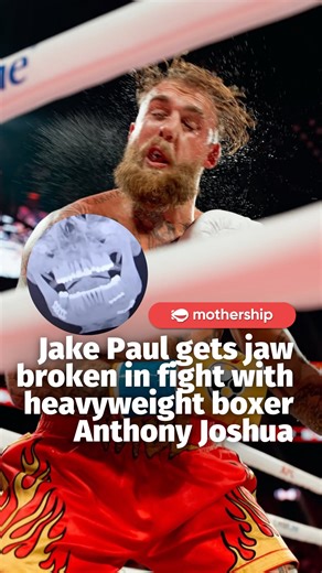 Mothership on Instagram: "YouTuber and professional boxer Jake Paul has had two titanium plates fitted and several teeth removed after Anthony Joshua broke his jaw during their boxing bout in Miami, the BBC reported. The 28-year-old was knocked down multiple times and stopped in the sixth round, marking the first stoppage loss of his boxing career. Paul later confirmed his jaw was broken in two places and shared that he will be on a liquid diet for 7 days following surgery. Despite the injury, P