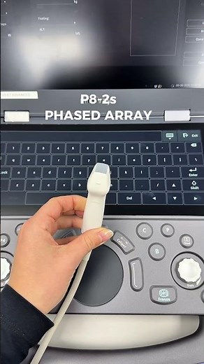 Phased Array for Echocardiography 🫀
