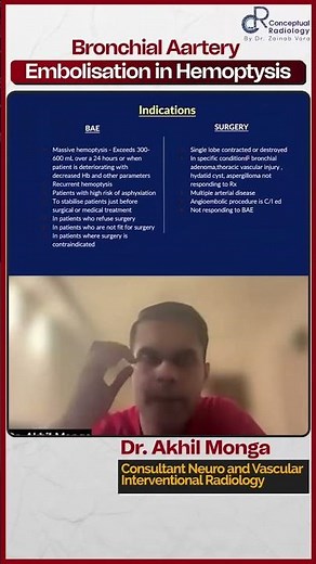 Bronchial Artery Embolisation in Hemoptysis by Dr. Akhil Monga | Conceptual Radiology