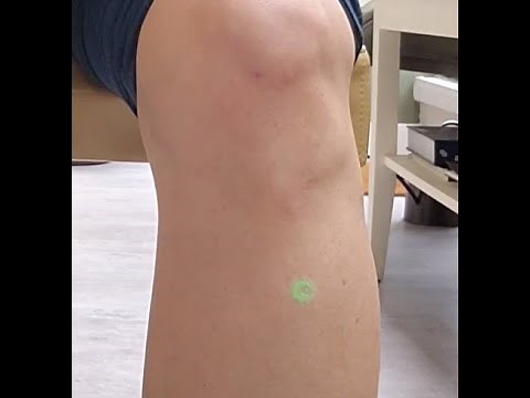 ST36 acupuncture/acupressure point