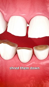 Why Grinding Your Teeth Is Bad 😱 | Zack D. Films