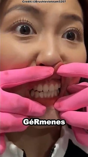 Why you MUST brush your teeth every day! 🪥😬 #shorts #reels #viralshorts #humor