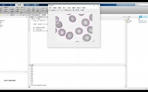 基于Matlab采用水平集方法图像分割(MATLAB)