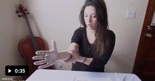 Reaction to the bionic prosthesis - Video