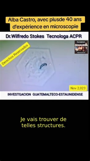 6.8K views · 137 reactions | Alba Castro, avec plus de 40 ans d' expérience en microscopie #sante #cds #detox #zeolite #5G #frequency #vaccination #Parasites | TanRési Résistant | Facebook